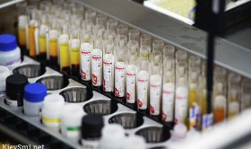 В России отмечен рост заболеваемости острым гепатитом А почти на 50%